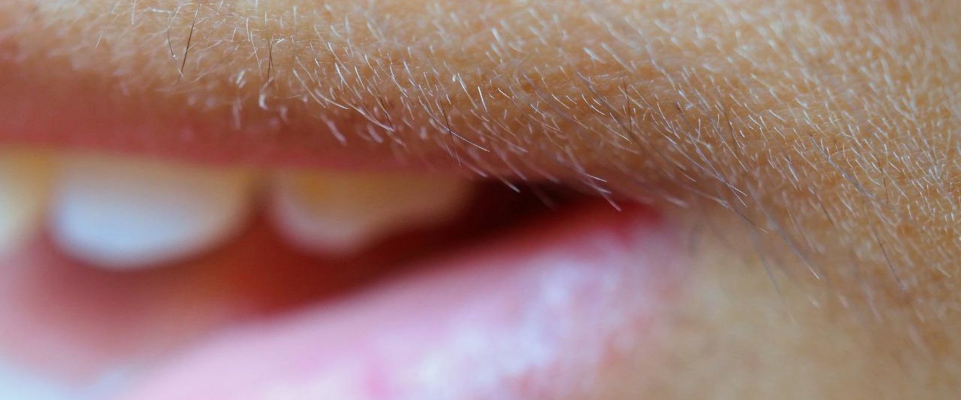 Does Hair Grow Back After Dermaplaning? An Expert's Perspective